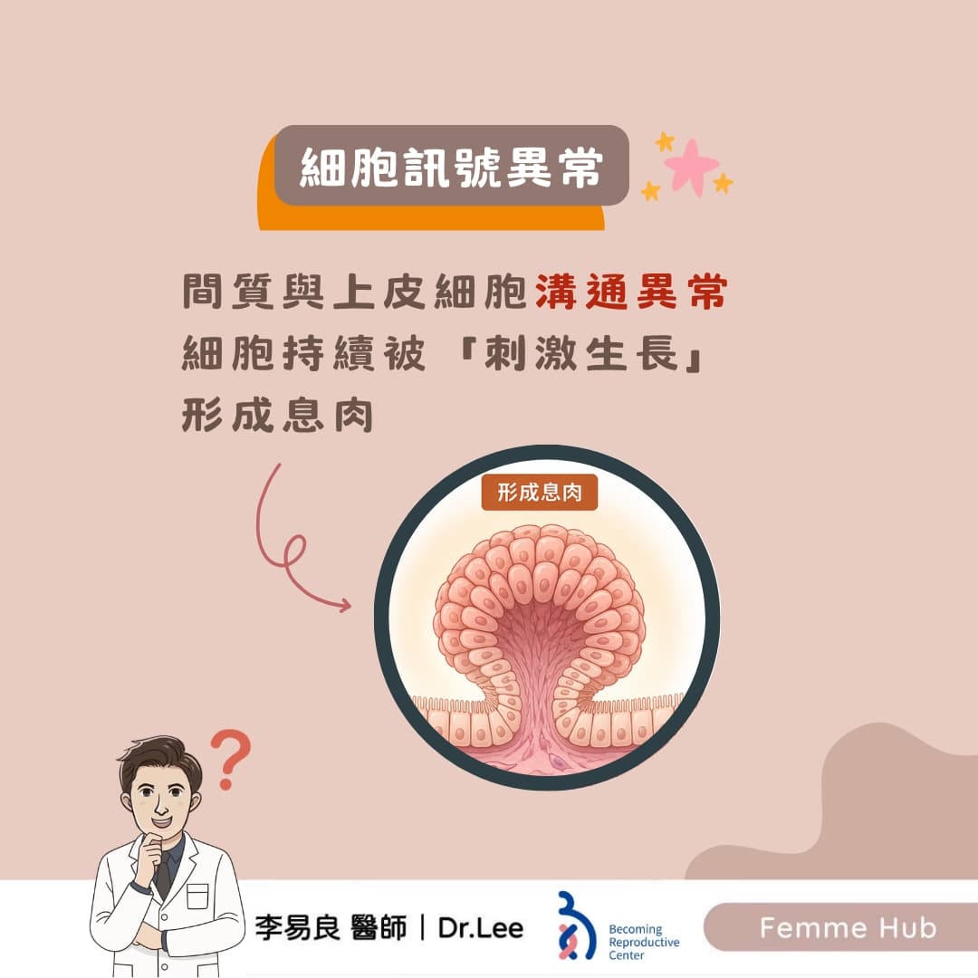 子宮內膜息肉:不只是雌激素的問題4.jpg