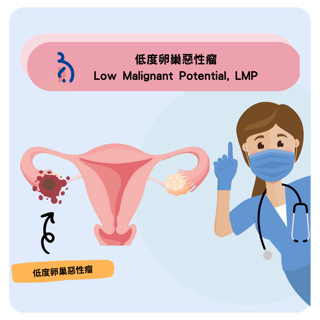 何謂低度卵巢惡性瘤（Low Malignant Potential, LMP）.png