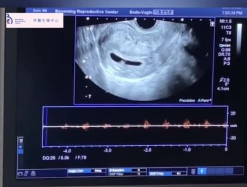 驗孕棒驚喜後的確幸💝.jpg