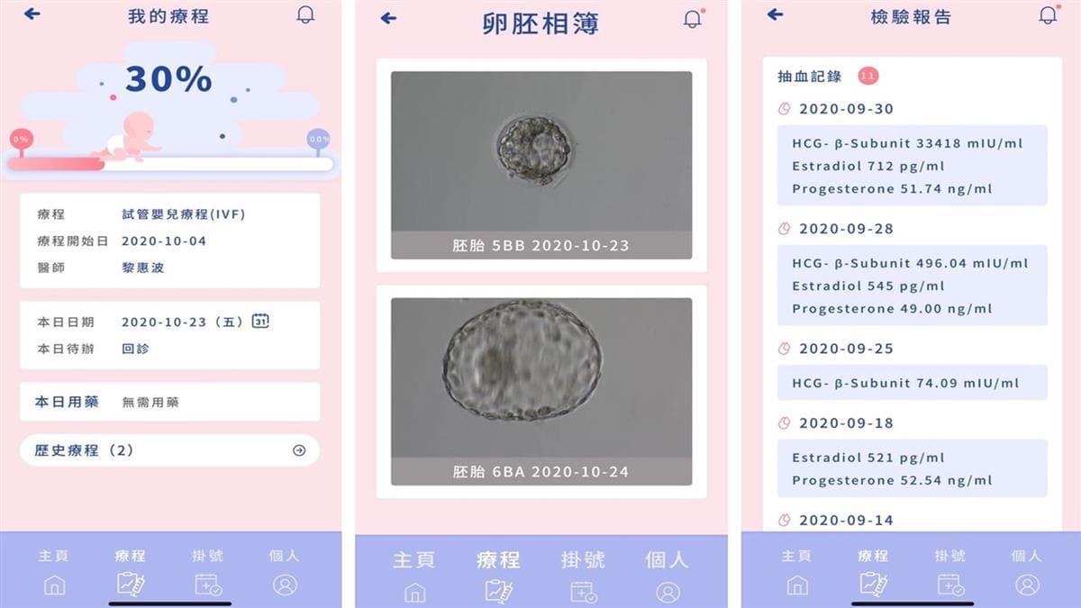 港台攜手合作使人工生殖醫學大躍進 啟動策略聯盟結合全球獨創智慧型醫療管理系統.jpg