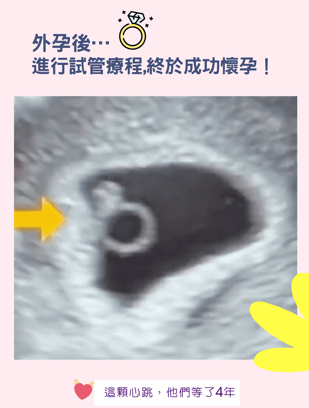 那顆閃閃發亮的小鑽石💎.png