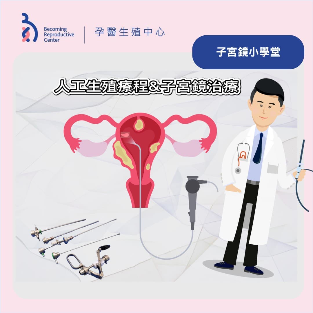 子宮鏡於不孕症之應用 .jpg