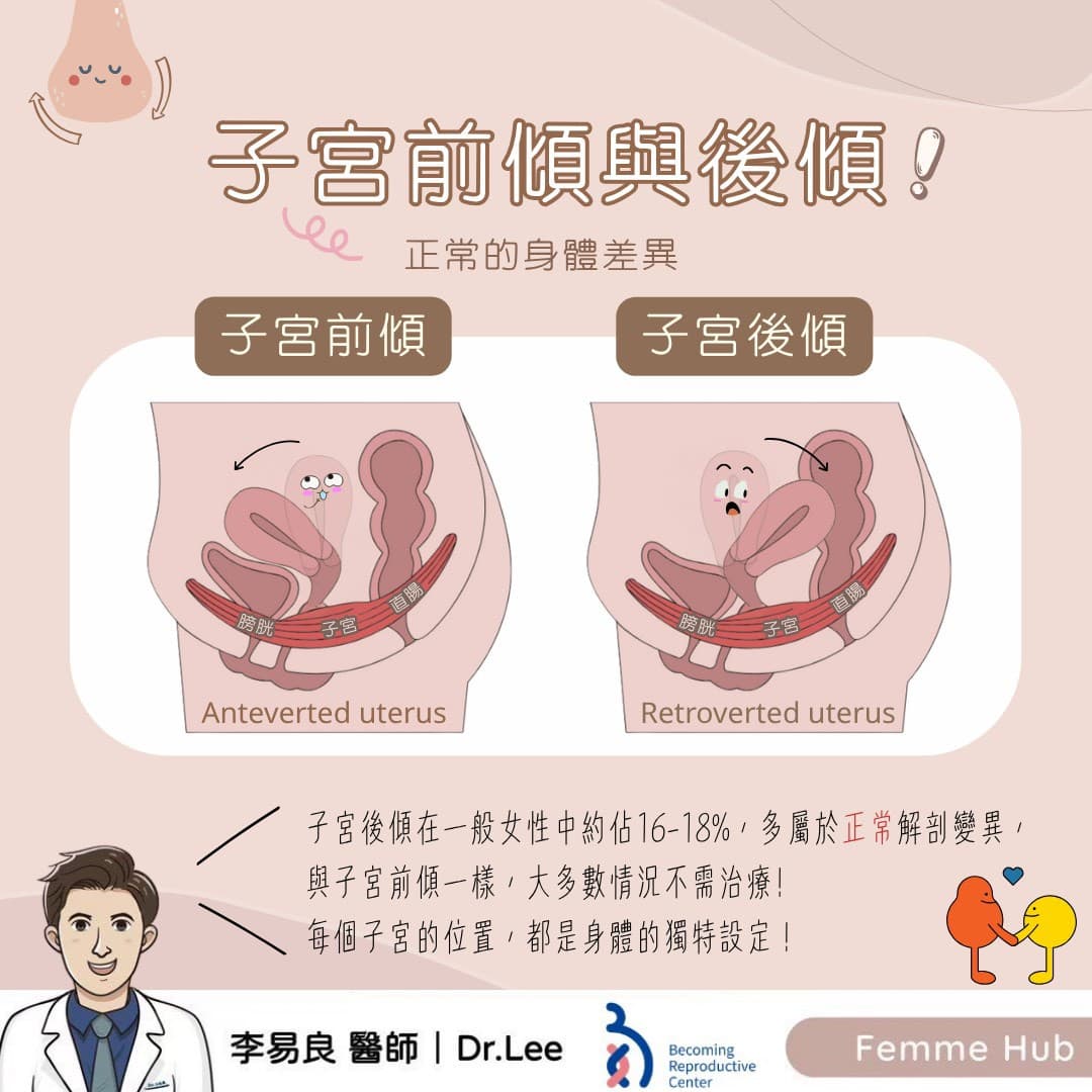 子宮前傾與後傾.jpg